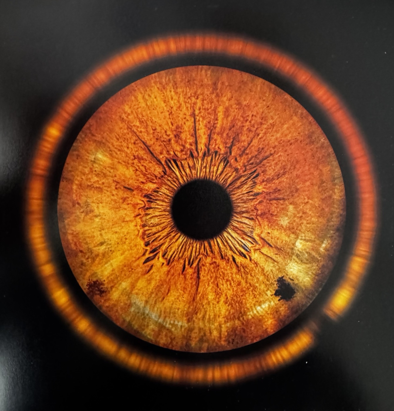 Photo macro de l'iris droit de Ben, annotée